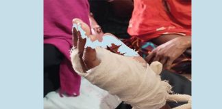 কুমারখালীতে বখাটের হামলায় কলেজছাত্রী আহত