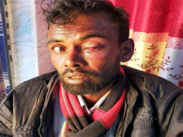 কুমারখালীতে মাদক বিক্রেতার হামলায় শ্রমিক আহত