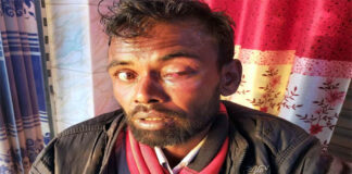 কুমারখালীতে মাদক বিক্রেতার হামলায় শ্রমিক আহত