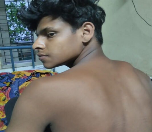 খোকসায় শ্রেণি কক্ষ ও পথে হামলায় আহত দুই ছাত্র হাসপালে ভর্তি