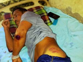 কুমারখালীতে ওয়ার্ড বিএনপির সভাপতির উপর হামলার অভিযোগ