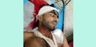 কুমারখালীতে মাদক বিক্রেতাদের হামলায় স্কুল ছাত্র জখম