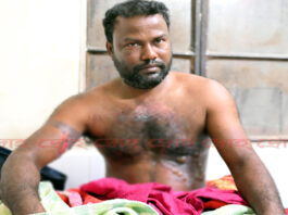 আখের গরম গুড়ে কৃষকের বুক ঝলসে দেওয়ার অভিযোগ