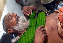 দৌলতপুরে স্বেচ্ছাসেবক দলের আহ্বায়কসহ ১০ জন গুলিবিদ্ধ