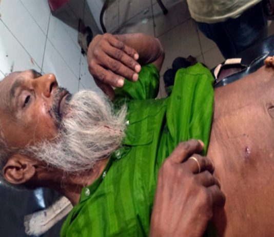 দৌলতপুরে স্বেচ্ছাসেবক দলের আহ্বায়কসহ ১০ জন গুলিবিদ্ধ