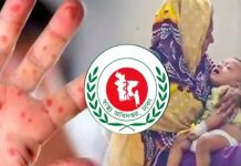 হাম ও উপসর্গে আরও ৭ মৃত্যু