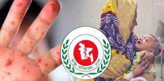হাম ও উপসর্গে আরও ৭ মৃত্যু